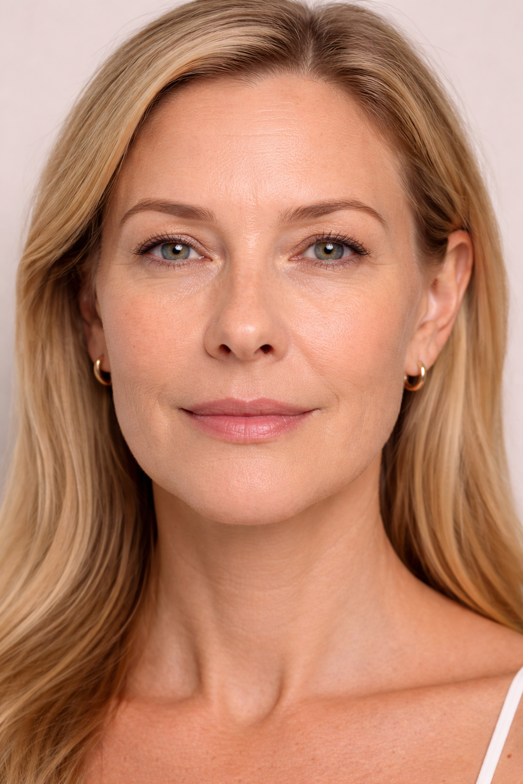 Before carbon laser peel treatment at Hera Wellness Studio